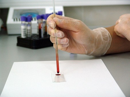 Blood test lab
