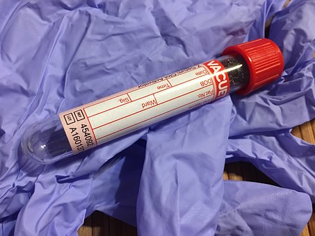 Blood container tube