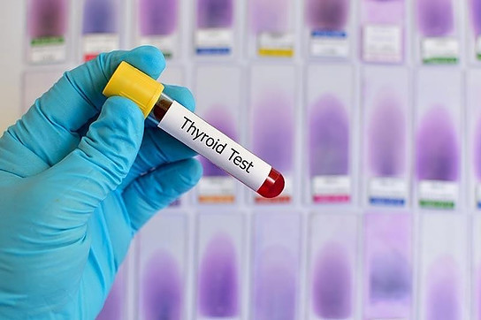 Thyroid Test